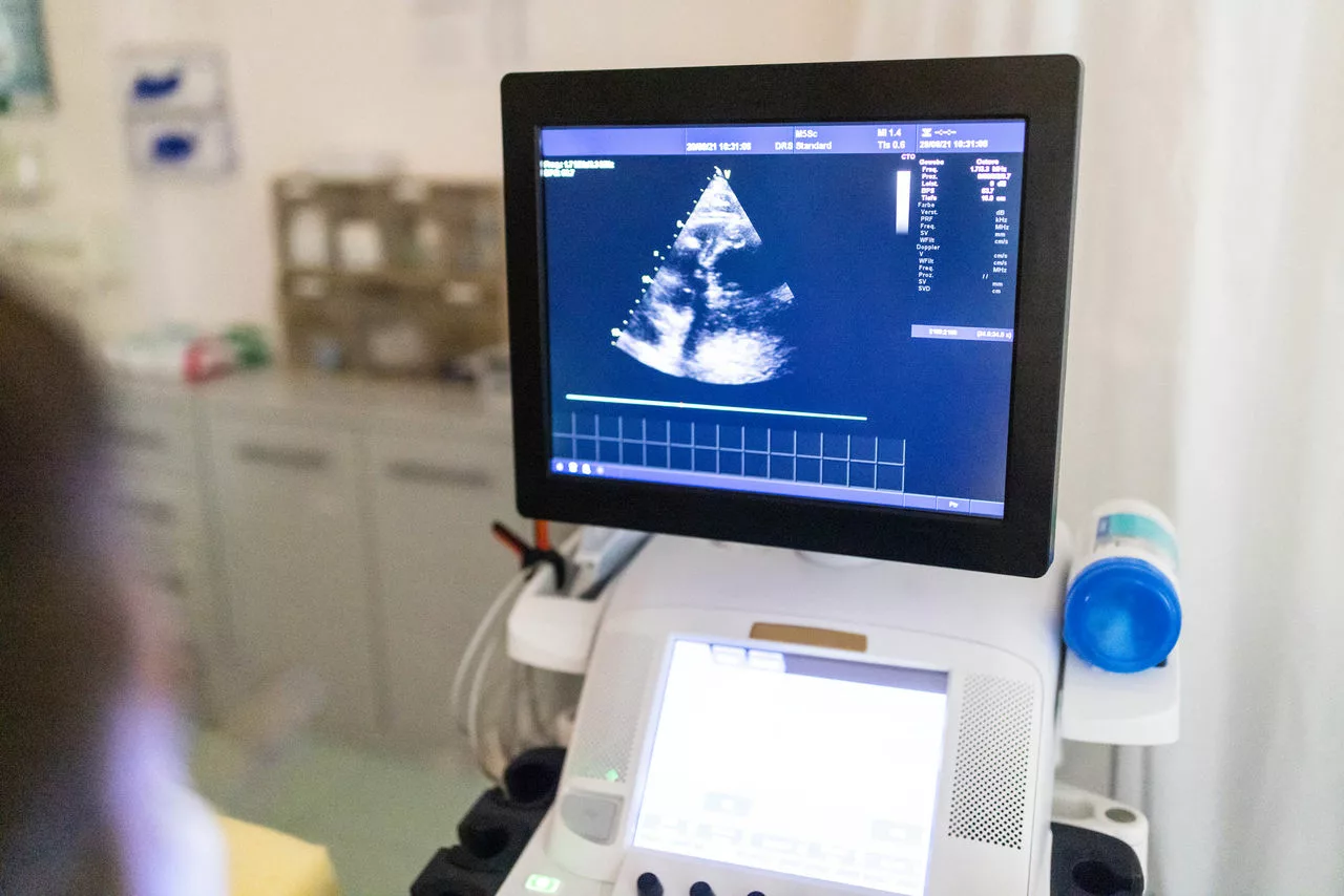 Image of Echocardiogram for monitoring any Diastolic Heart Failure