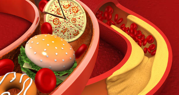 Image showing how unhealthy life choices can cause the blockage of blood arteries.