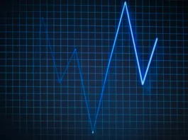 Supraventricular tachycardia