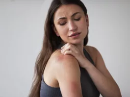 pellagra causing rash to woman