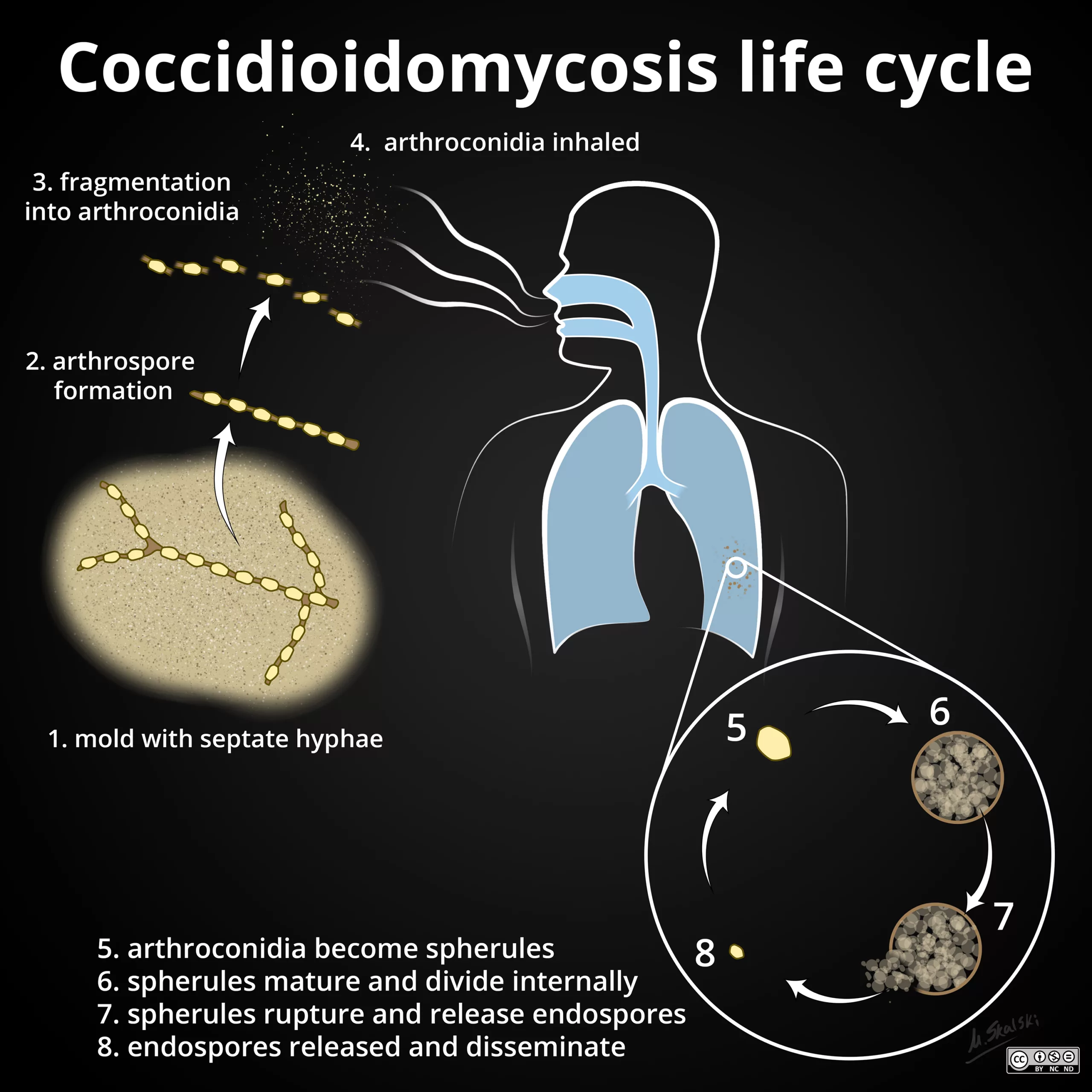 Life cycle of Coccidioidomycosis