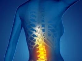 Lumbar vertebrae, A common site for herniated discs