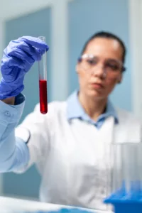 Image of a doctor holding a blood sample for Anemia Hereditary