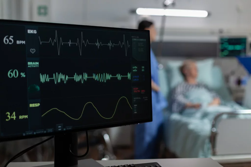 EKG Monitor image to diagnose Atrial Fibrillation