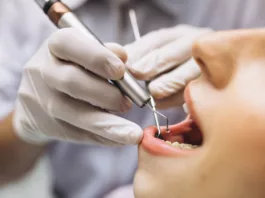 Image of a woman getting treatment for Hyperdontia