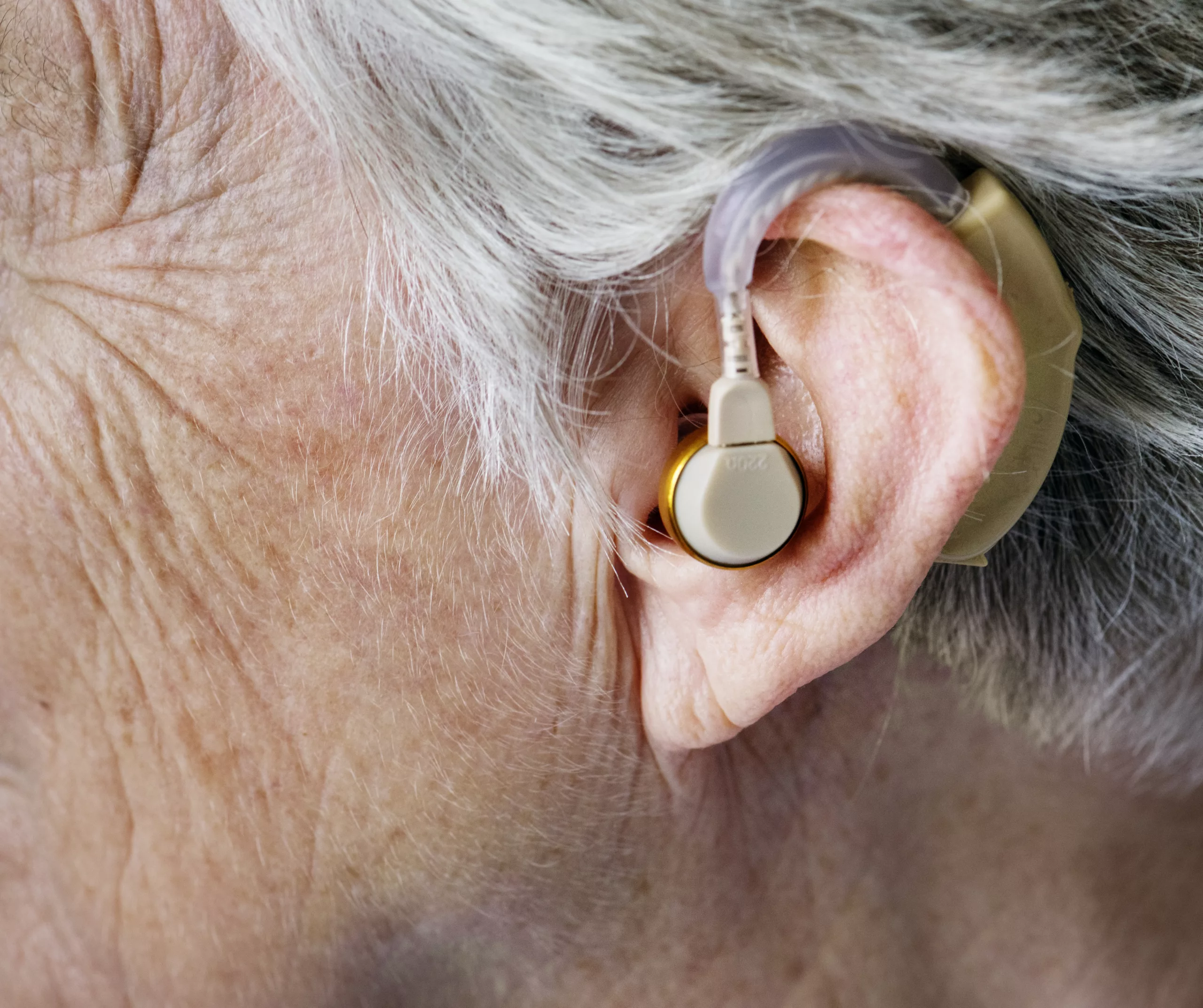 Image of an elderly woman with hearing aid - Otosclerosis