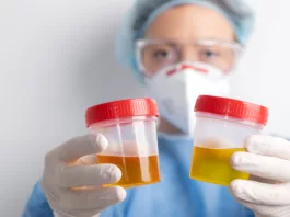 Image of a doctor performing urine examination