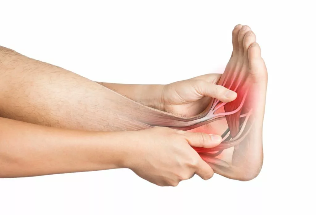 Image of a foot with Peroneal tendonitis