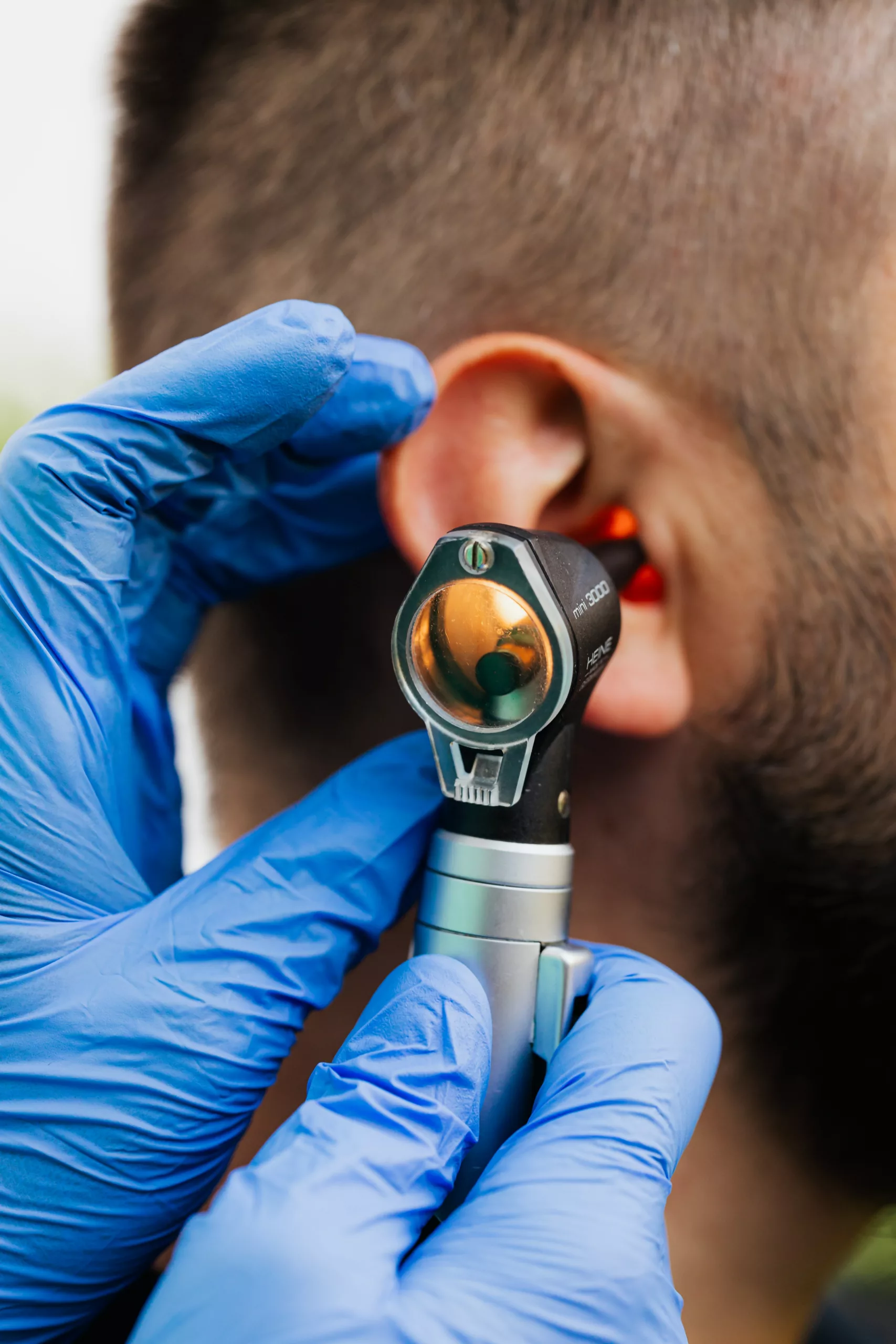 Image of Otoscopic examination being performed on a patient suffering from Otosclerosis