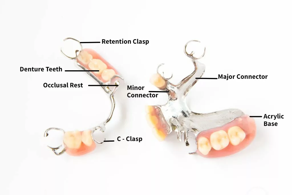 Components of Removable Partial Denture