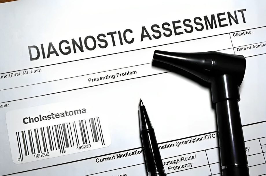 Diagnosis of Cholesteatoma