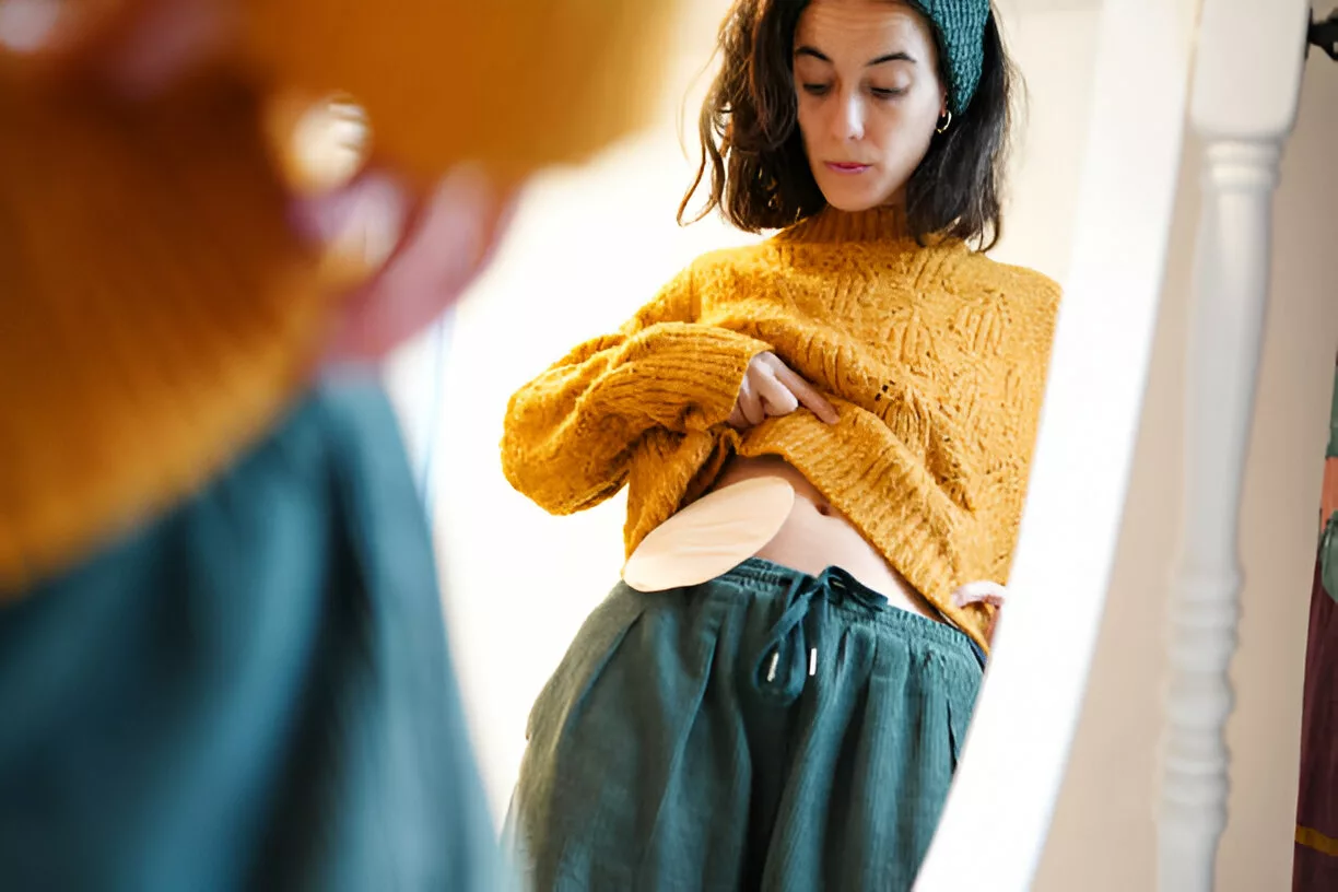 A woman looking at her colostomy bag