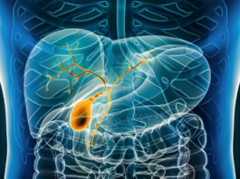 Gallbladder with bile duct and biliary tree