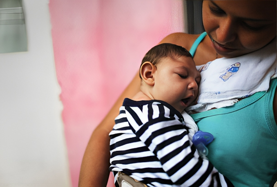 image of a child with Smith-Lemli-Opitz syndrome have microcephaly