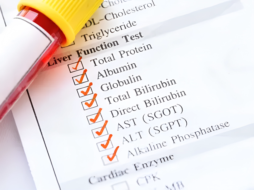 Blood tests to diagnose biliary dyskinesia