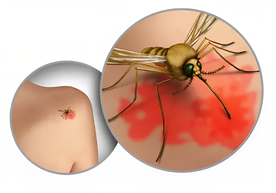 West Nile Virus transmission