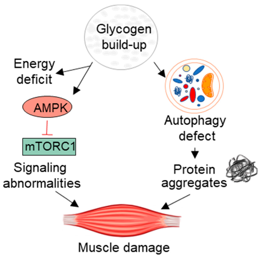 Pathogenic Cascade of muscle damage in Pompe disease