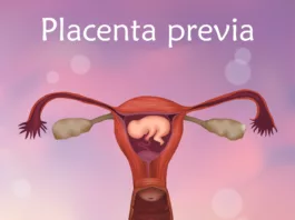 Placenta Previa