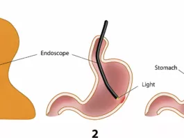 An image giving the overview of EGD