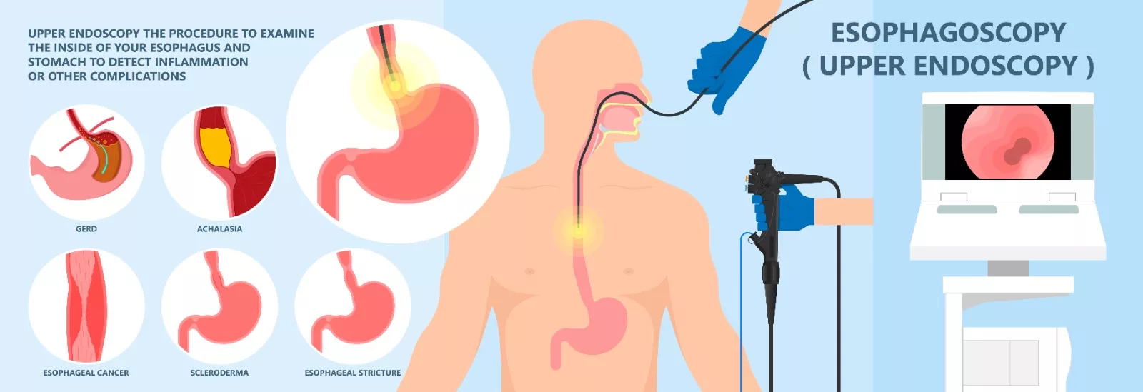 The image shows the indications of an EGD