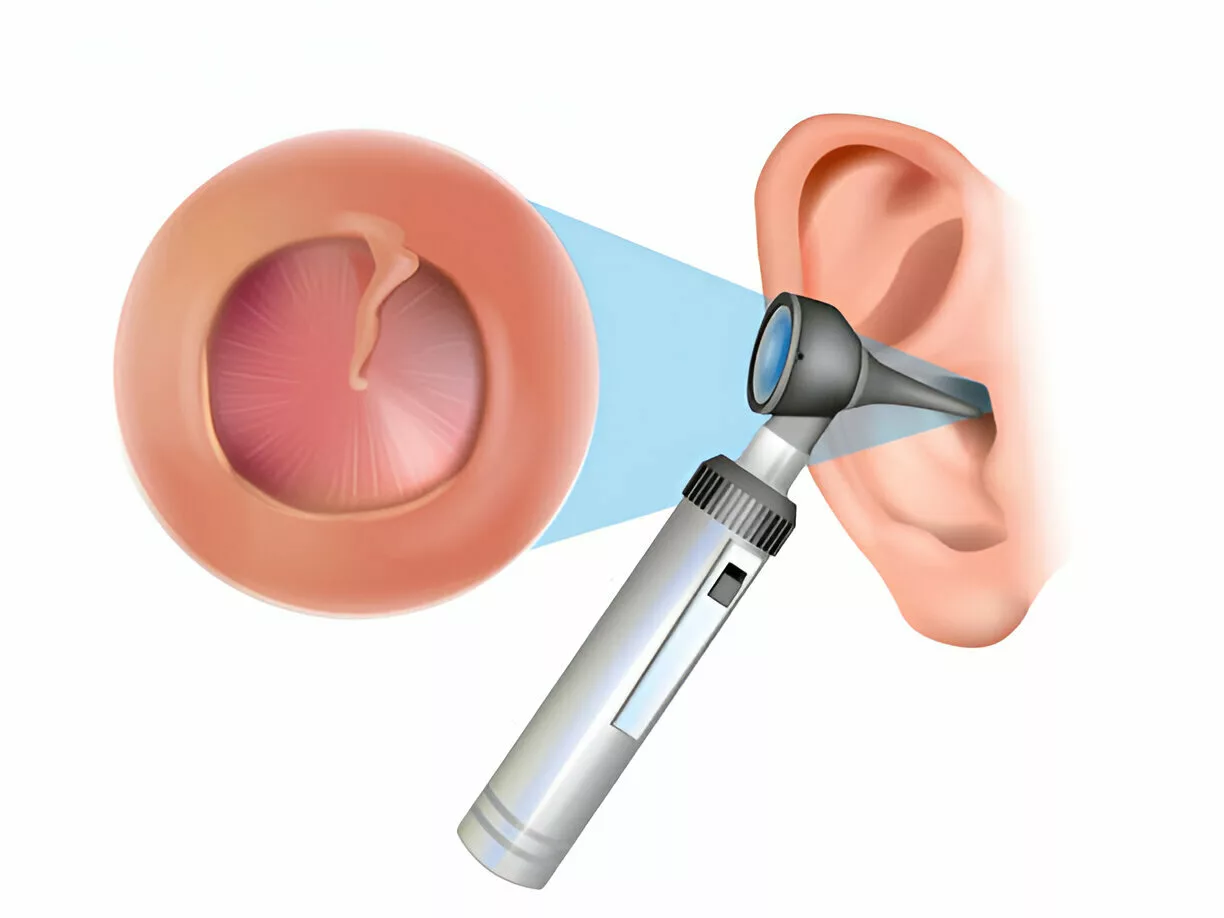 Otoscope for examining the ear