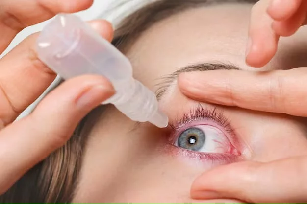 Artificial tears to help with irritation caused by Ocular Rosacea