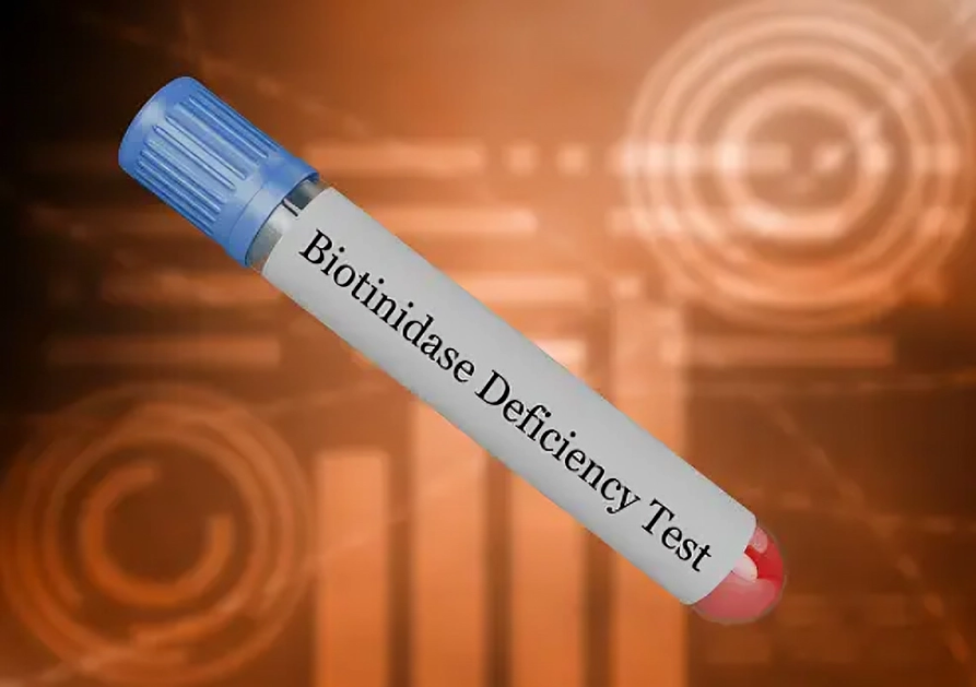 Blood collected in a test tube to check biotinidase levels in the body