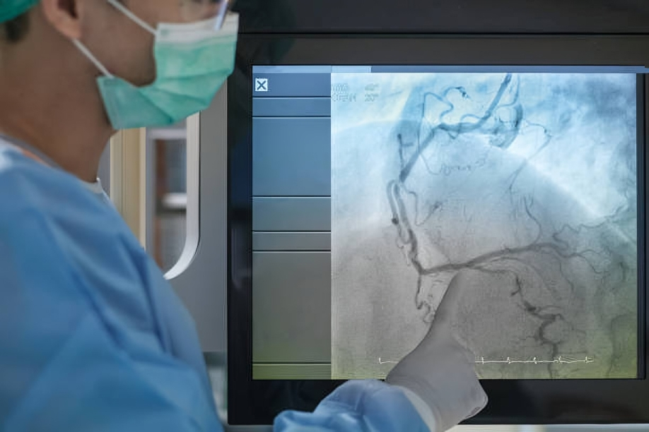 Coronary angiogram on X-ray