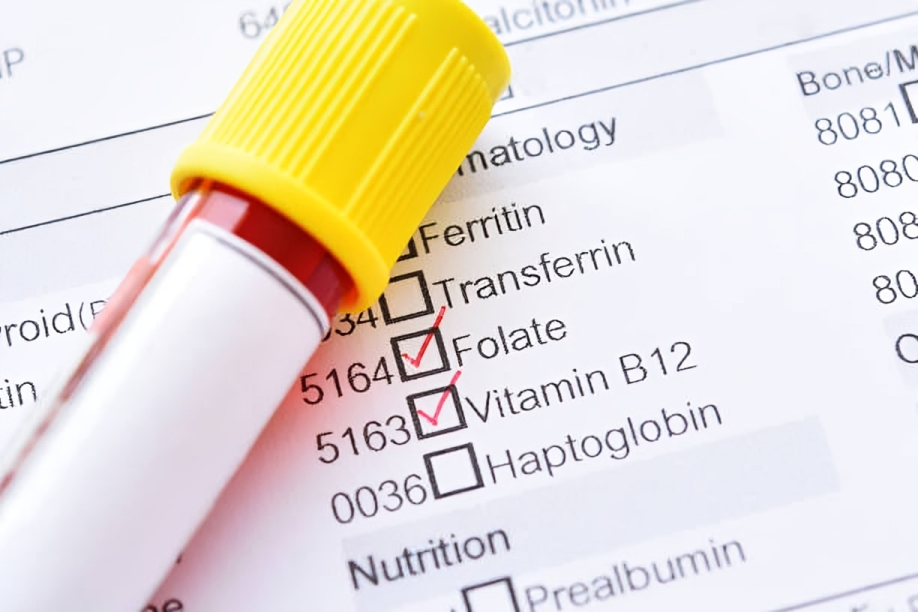 Investigations for megaloblastic anemia