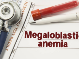 Megaloblastic anemia