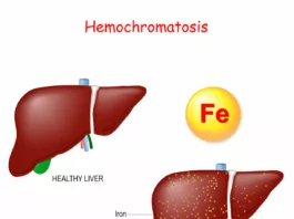 Hemochromatosis