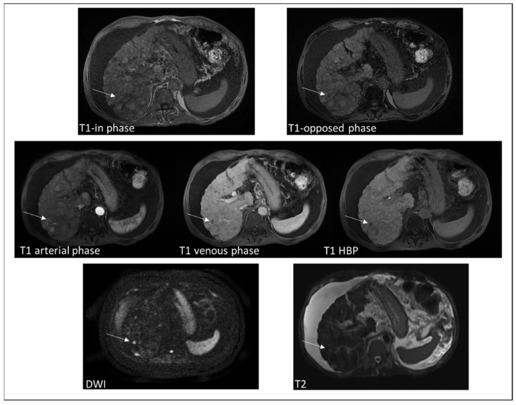 MRI Image