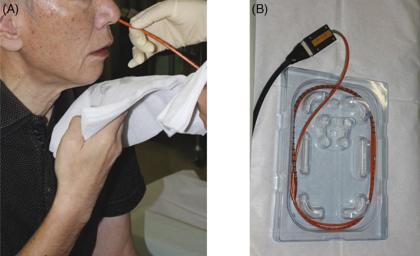 Esophageal Manometry