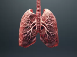 Sarcoidosis-of-lungssymptoms-of-sarcoidosis-in-lungs-treatment-for-sarcoidosis-of-lungs-sarcoidosis-of-the-lungs-prognosis-stages-of-sarcoidosis-of-the-lungs-sarcoidosis-lungs-life-expectancy