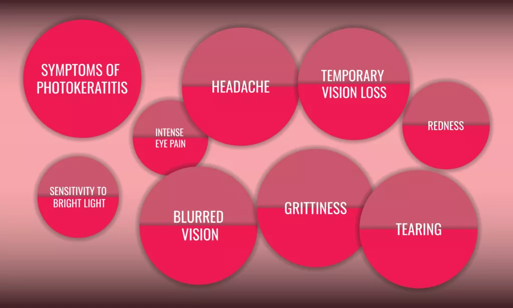 Symptoms Of Photokeratitis