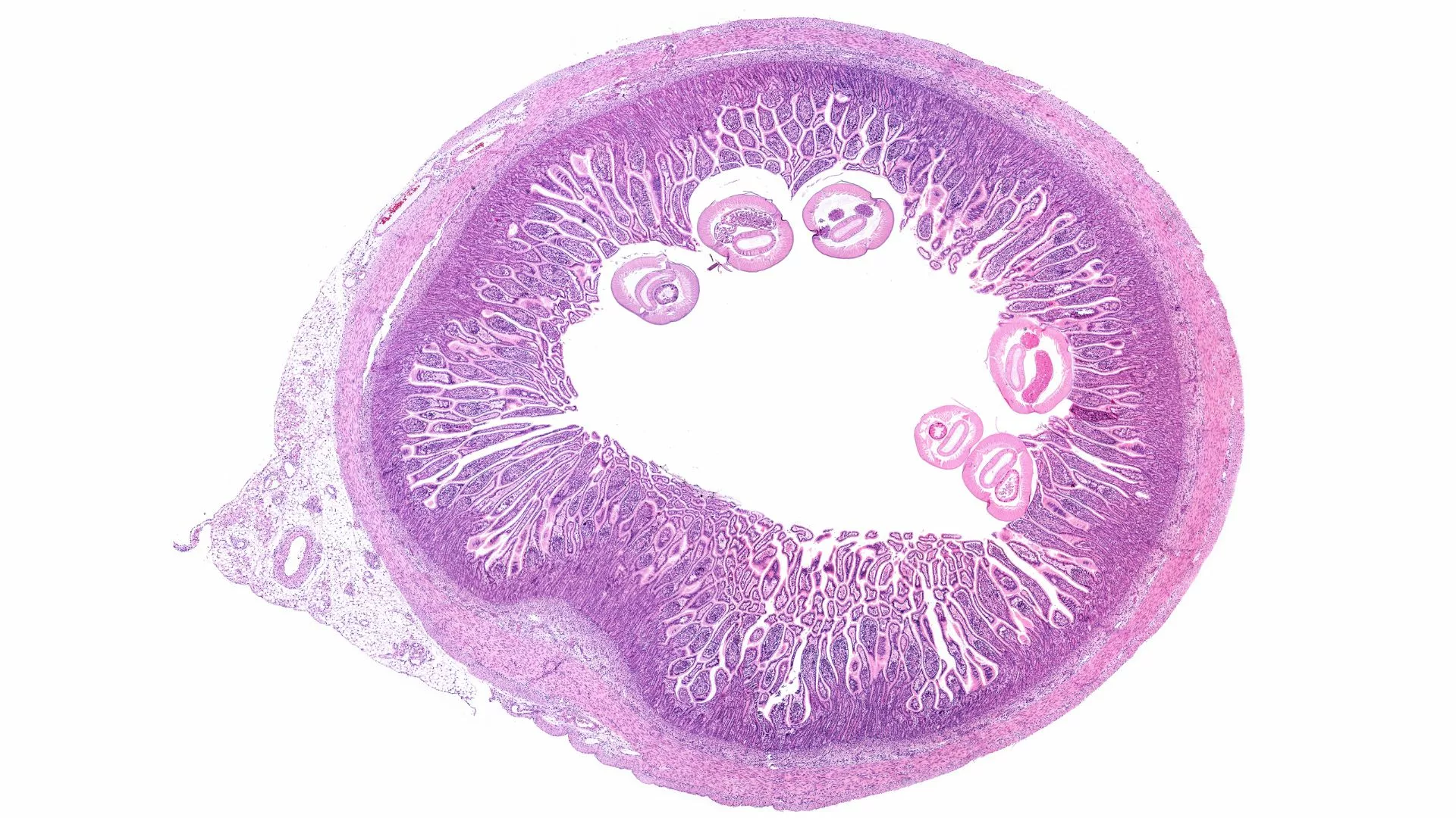 Pinworm (Enterbious Vermicularis) attached to the mucosa of the small intestine 