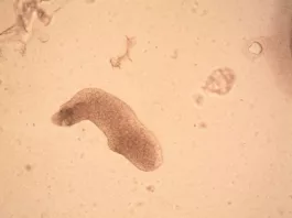 Amoebiasis parasite