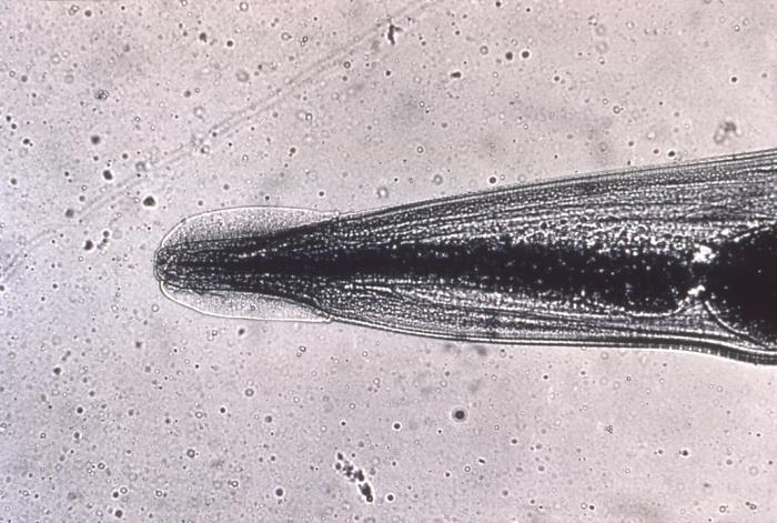 pinworm photomicrograph