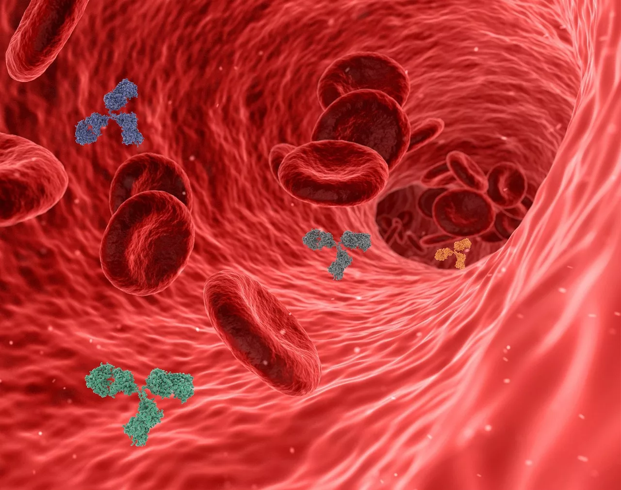 Shiga toxin causes hemolytic uremic syndrome