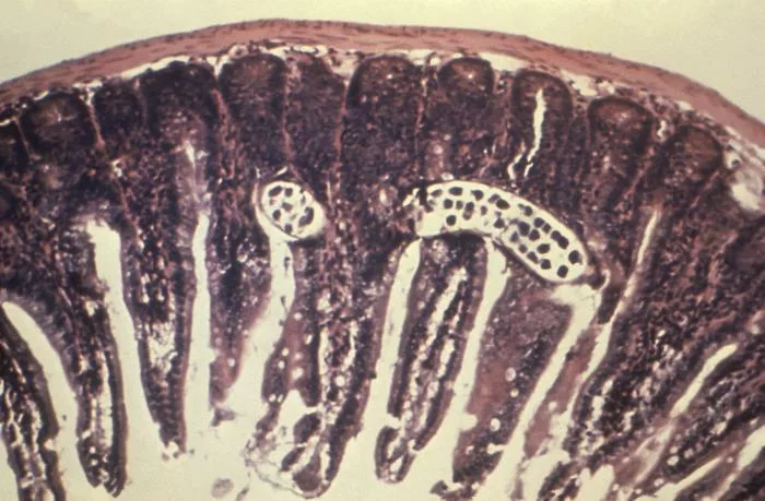 Photomicrograph of an intestinal mucosa tissue specimen, revealing the presence of a Trichinella spiralis