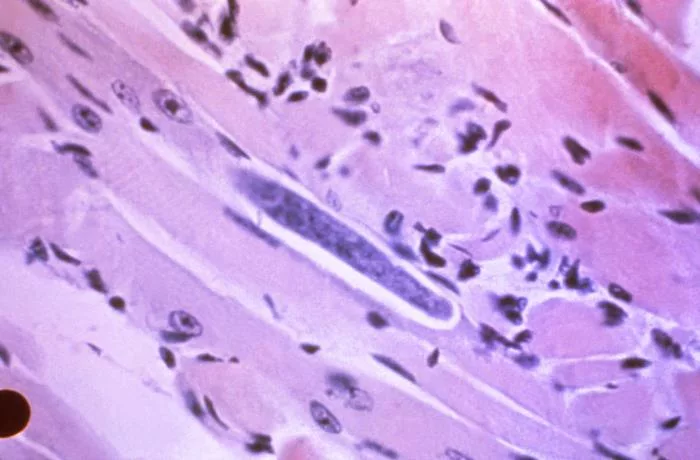 Photomicrograph of a muscle tissue sample, revealing the presence of a Trichinella spiralis larva