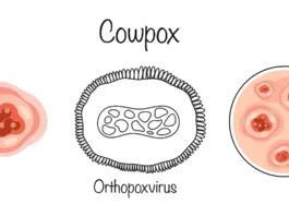 Cowpox