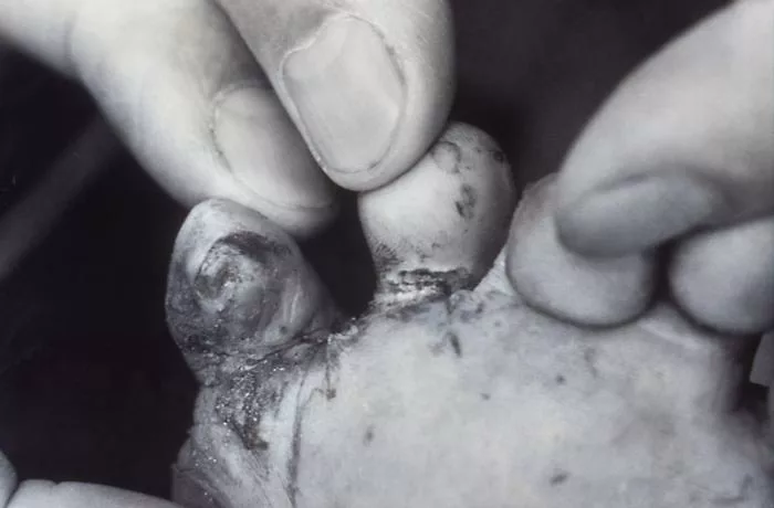 a close view of the toes of a child’s left foot