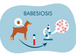 Babesiosis