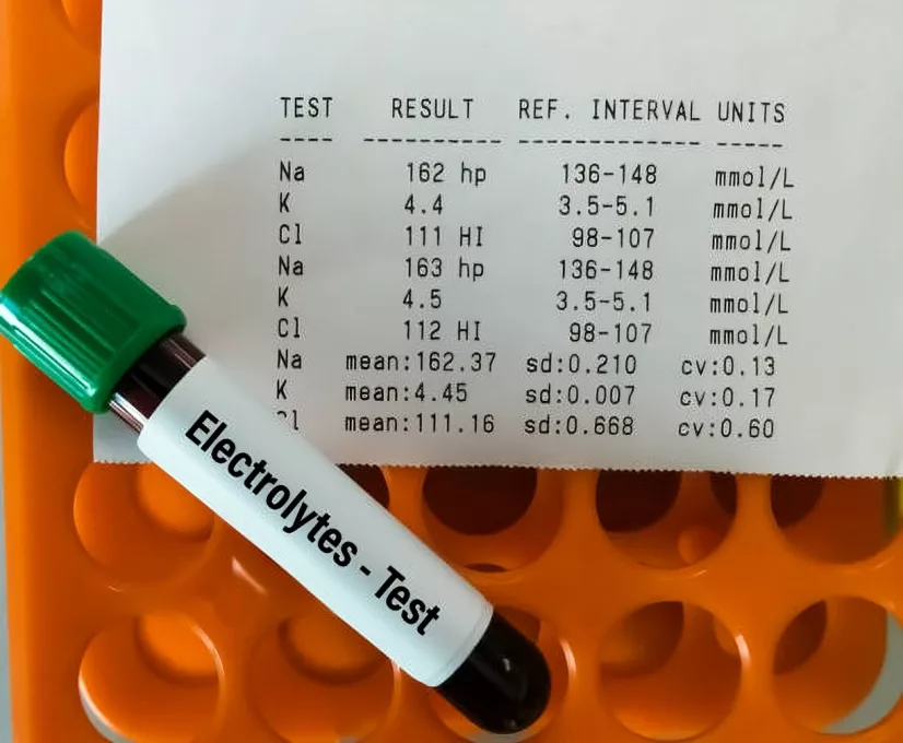 Electrolytes test to diagnose pyloric stenosis