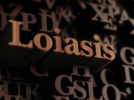 Loiasis