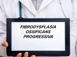 Fibrodysplasia Ossificans Progressiva