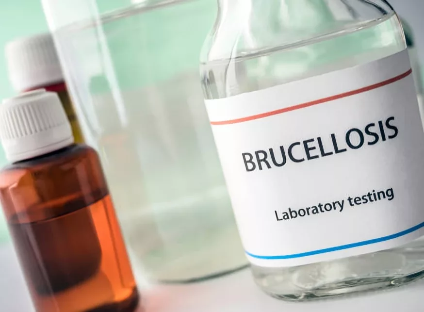 Laboratory testing of Brucellosis