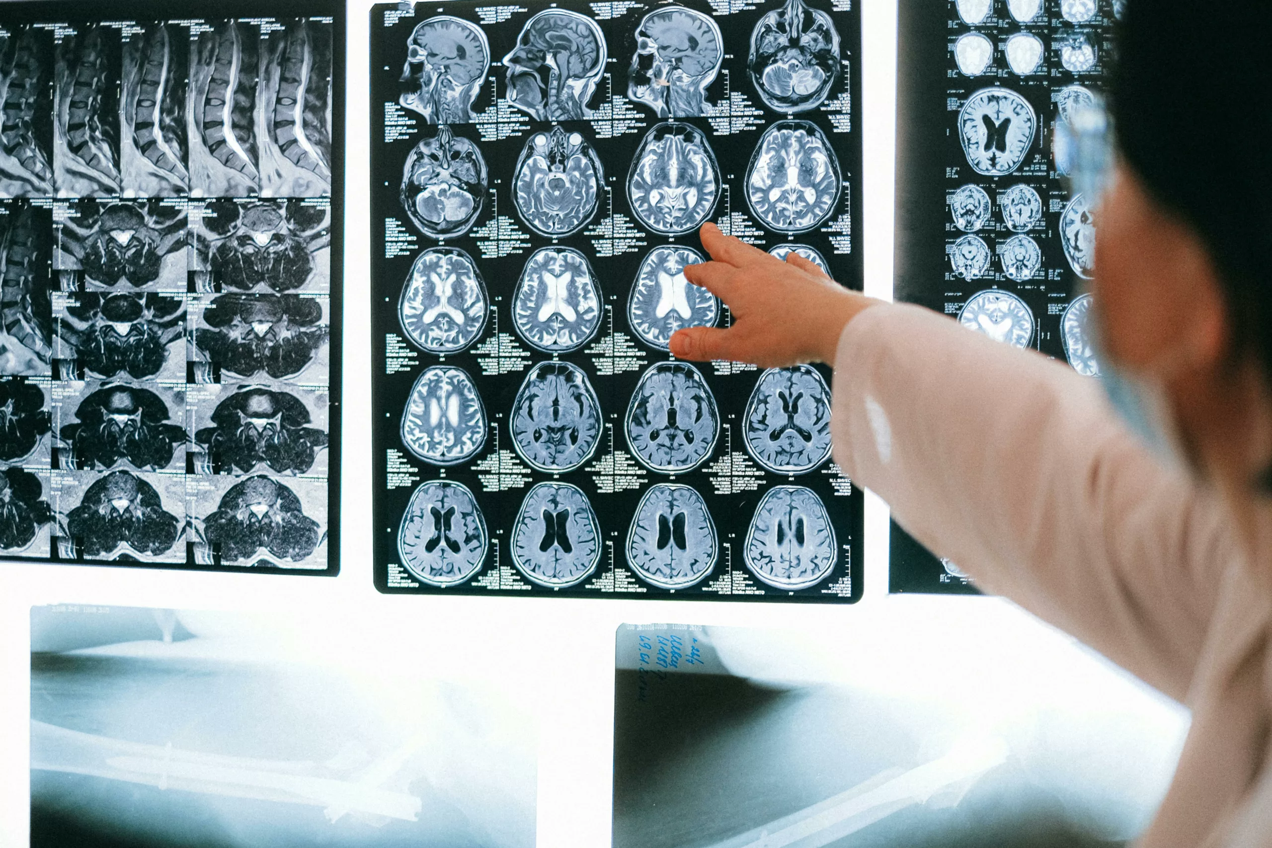 Doctor Examining the MRI of Brain