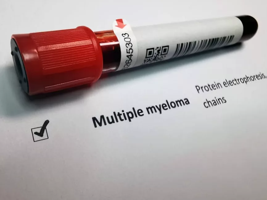 multiple myeloma